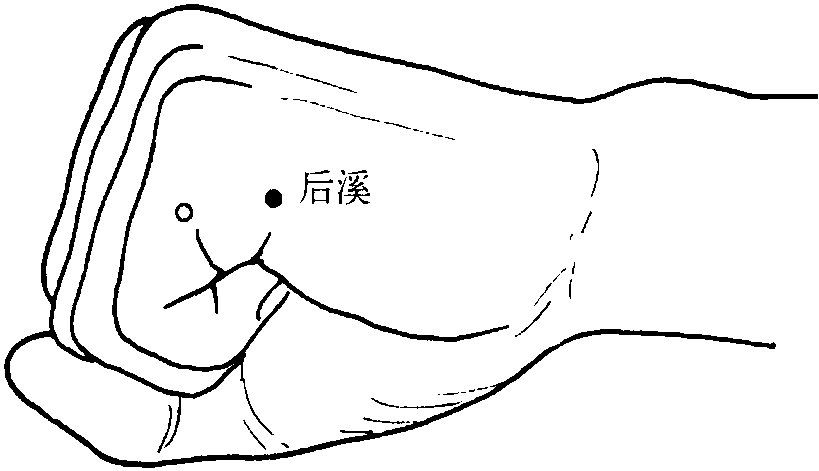 第四十五節(jié) 腰扭傷